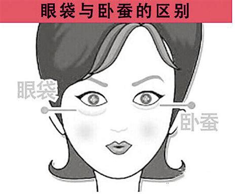 臥蠶肥大面相|面相學｜擁有臥蠶的面相，運勢究竟如何呢